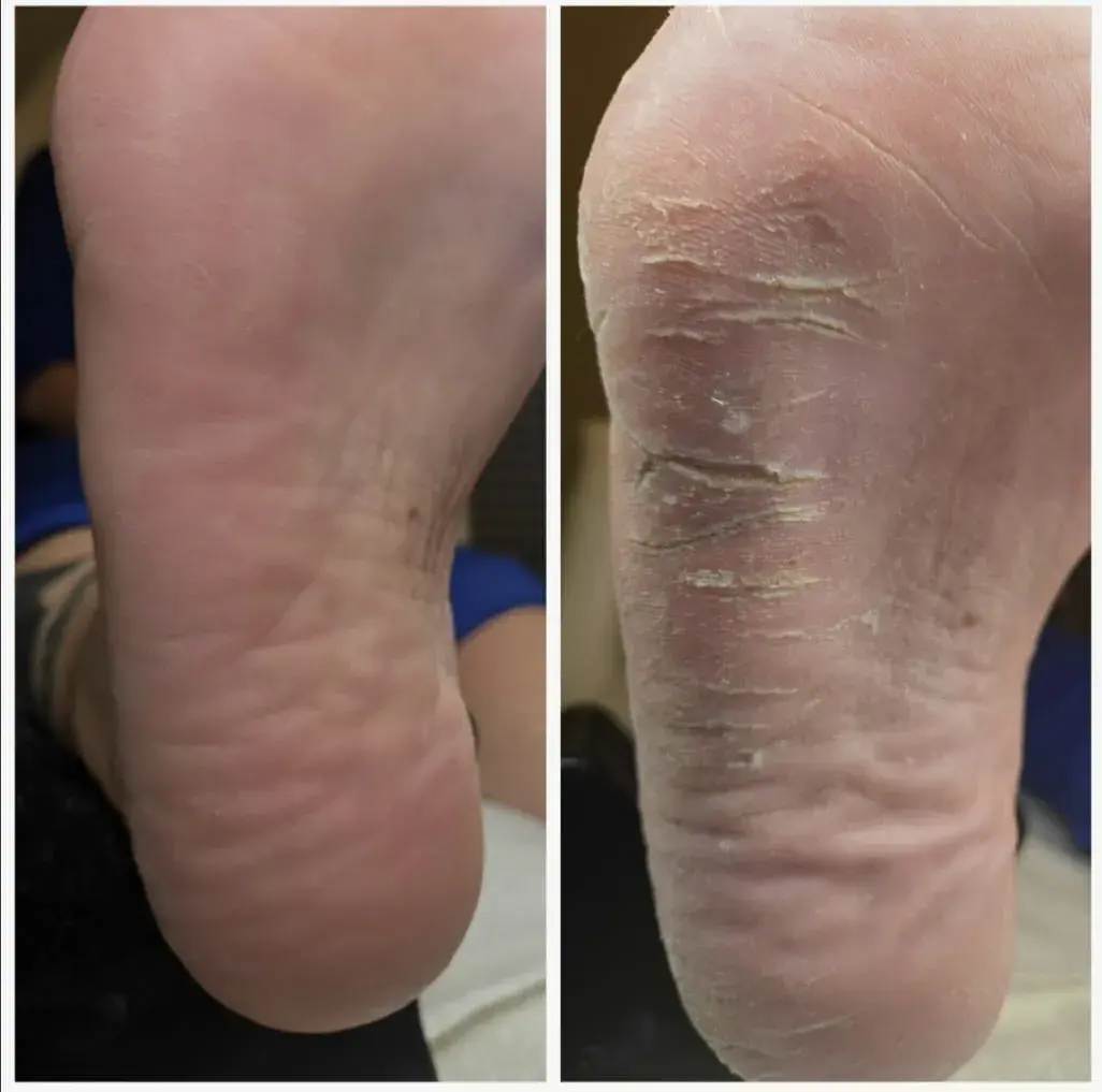 Zapraszam na stylizację paznokci oraz pedicure kosmetyczny. Hoek van Holland | HOEK VAN HOLLAND